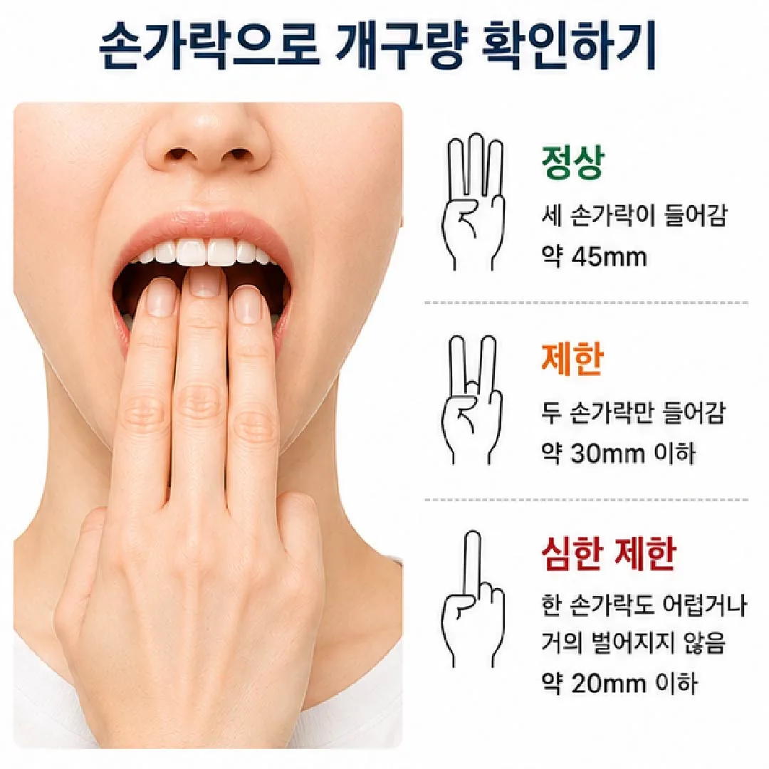 손가락 세 개로 입 벌어지는 정도를 확인하는 방법 도해
