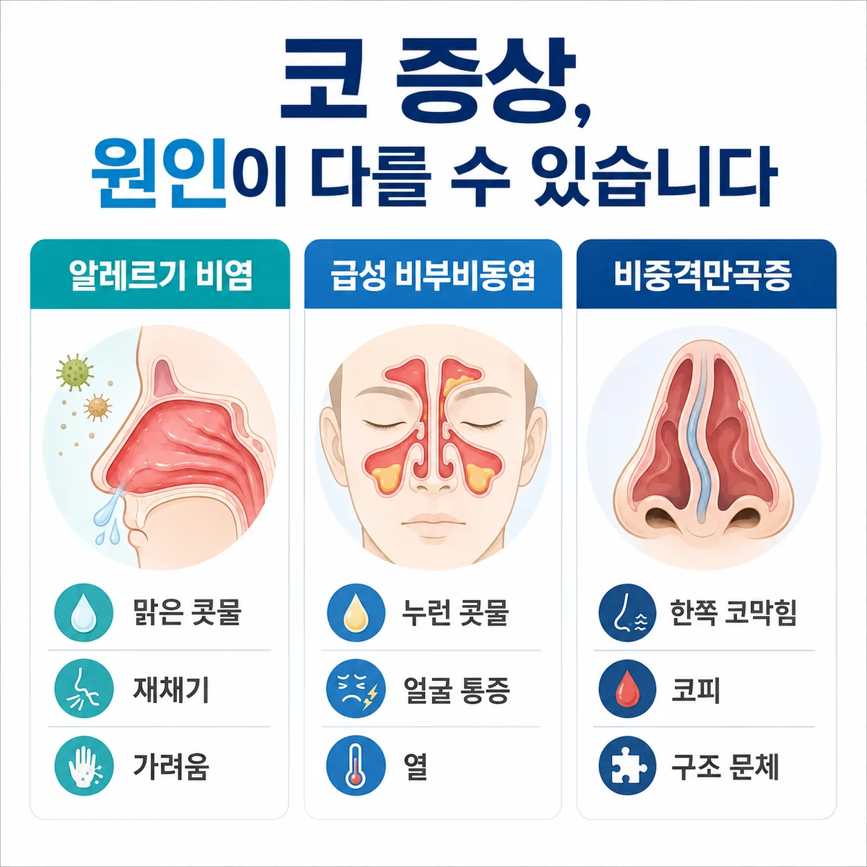 알레르기 비염 부비동염 비중격만곡증 감별 그림