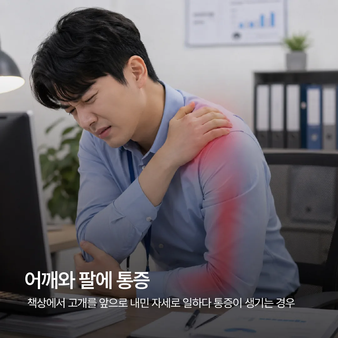 목디스크 증상으로 어깨와 팔에 통증을 느끼는 사무직 근로자