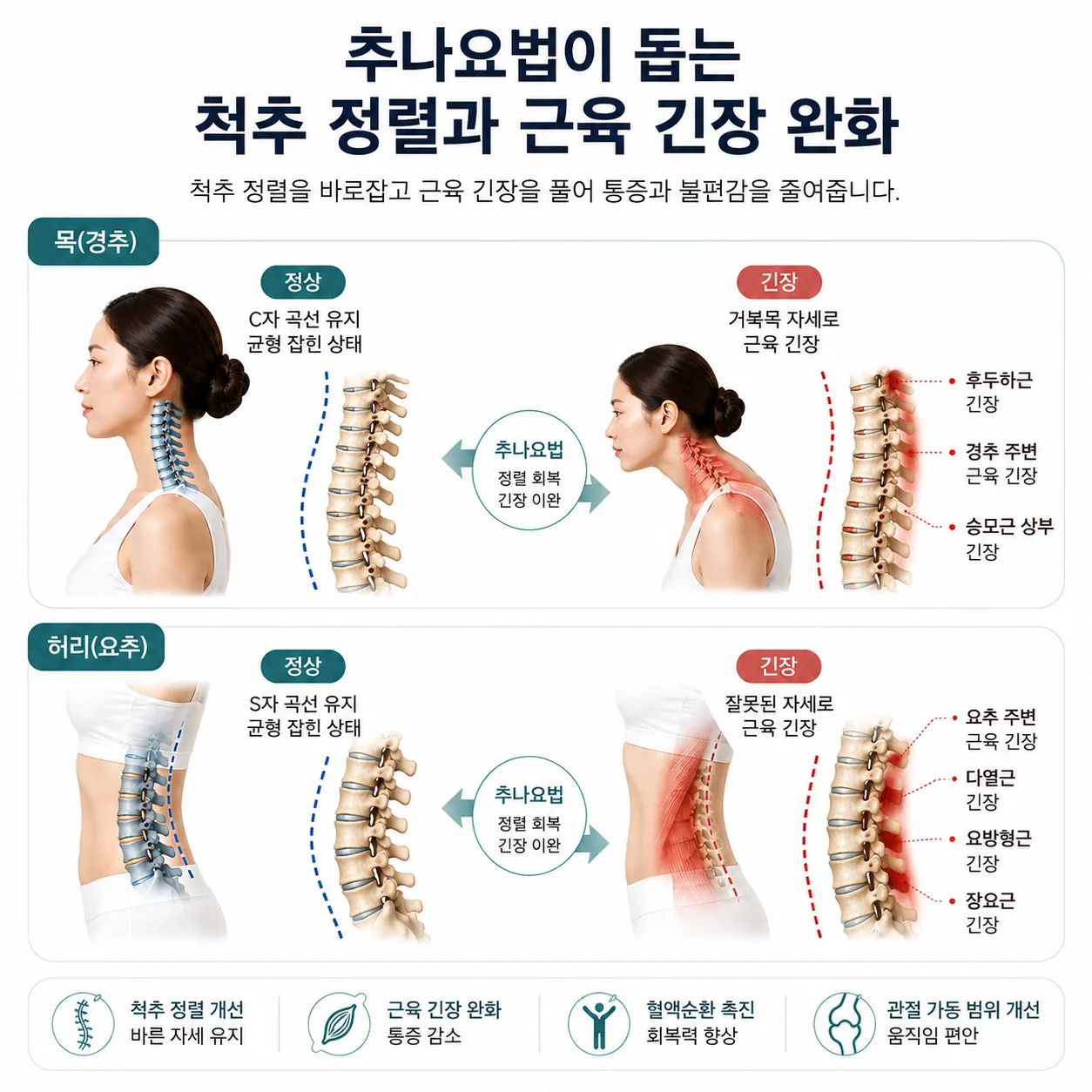 추나요법이 작용하는 척추 정렬과 근육 긴장 부위 도해