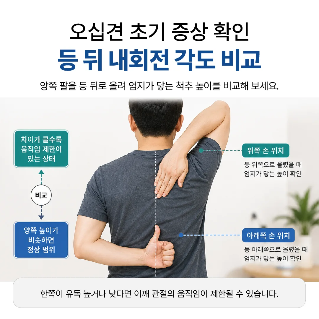 오십견 초기증상 확인을 위해 등 뒤 내회전 각도를 양쪽 비교하는 모습