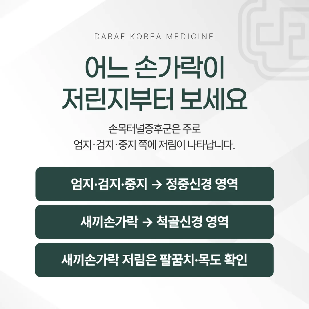손목터널증후군의 정중신경 저림 영역과 새끼손가락 쪽 척골신경 영역을 비교한 손바닥 개념도