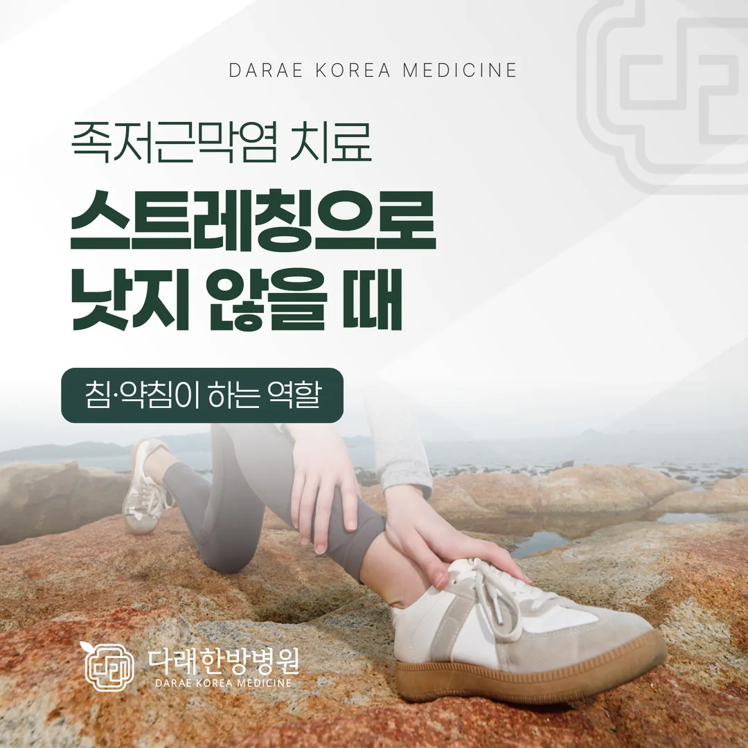 족저근막염 치료, 스트레칭으로 낫지 않을 때 — 침·약침이 하는 역할