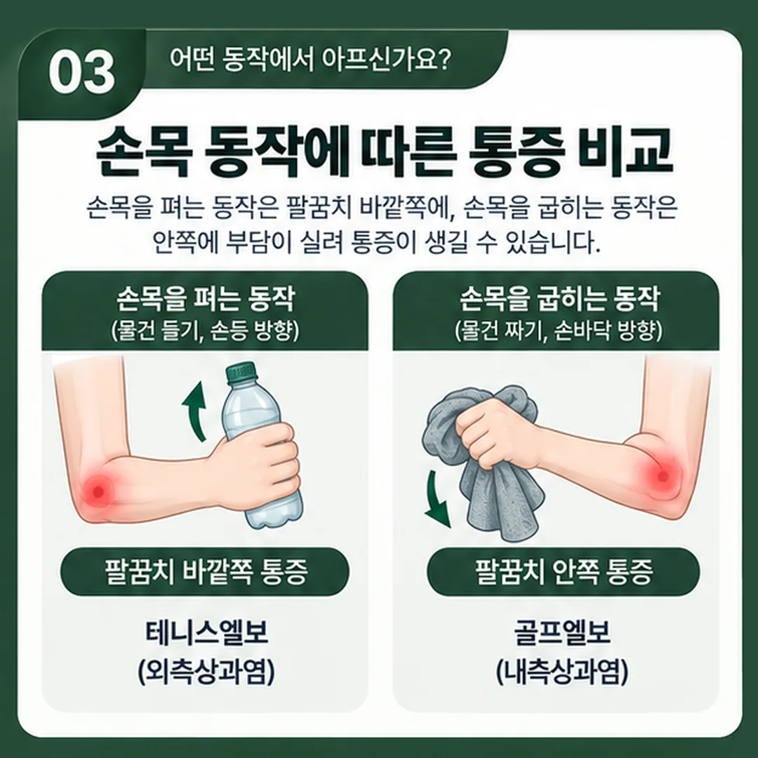 손목을 펴는 동작과 굽혀 짜는 동작에서 부담이 실리는 팔꿈치 부위를 나란히 비교한 그림