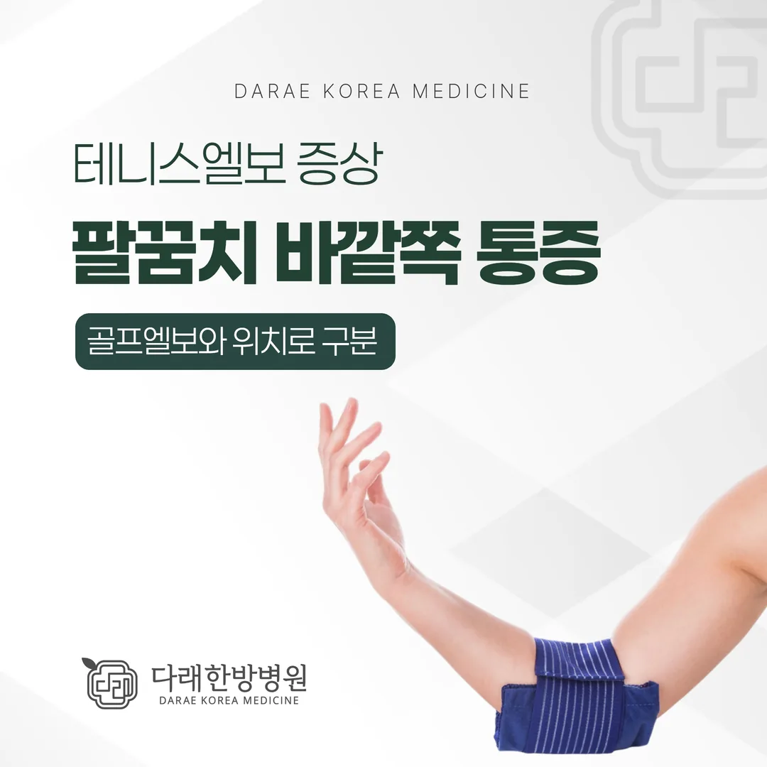 테니스엘보 증상, 팔꿈치 바깥쪽 통증 — 골프엘보와 위치로 구분