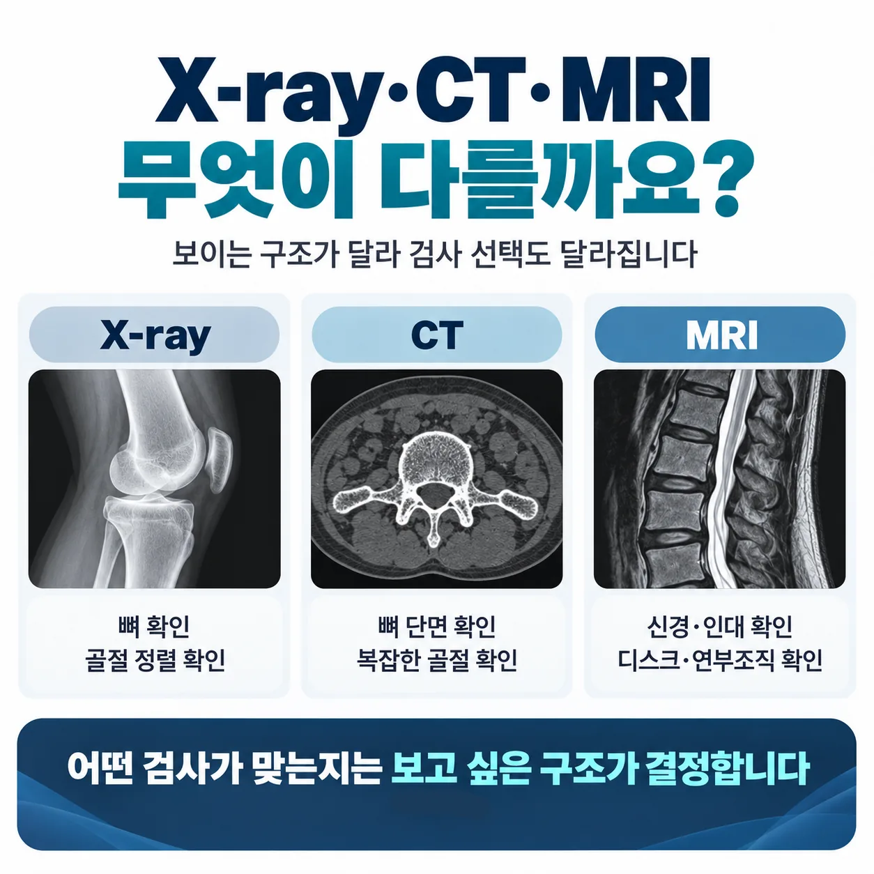 X-ray CT MRI가 각각 잘 보여 주는 구조를 비교한 도식