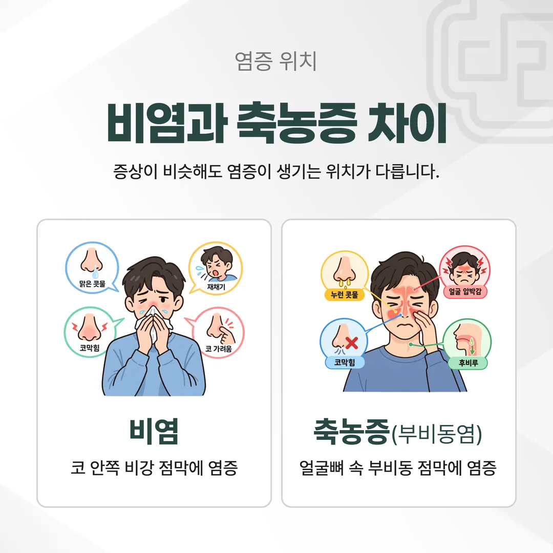 비염은 비강 점막, 축농증은 부비동 점막에 염증이 생긴 자리를 비교한 단면 도식
