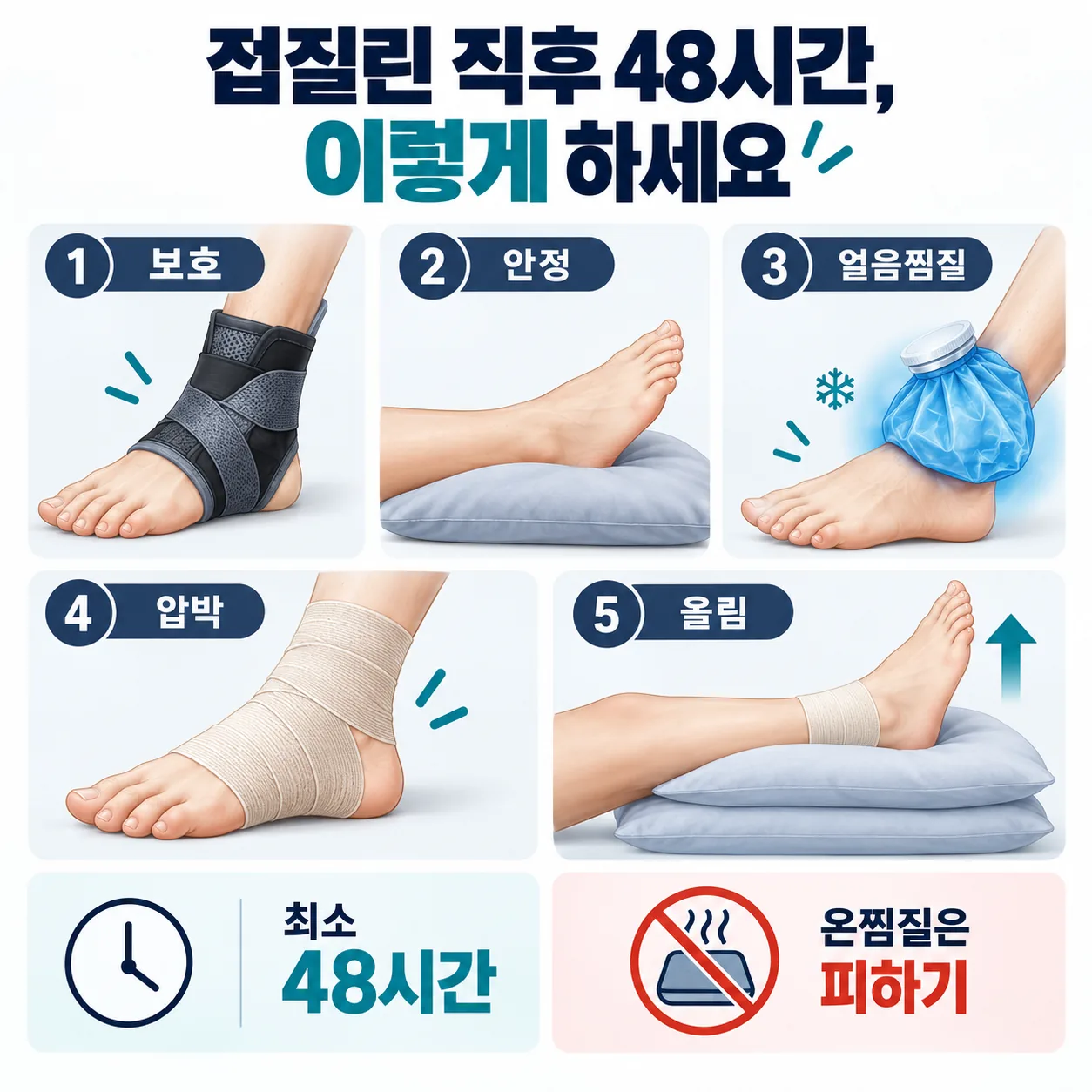발목을 접질린 직후 48시간 동안 지키는 다섯 가지 처치를 순서대로 정리한 표